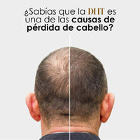 DHT Blocker Anticaída Premium – Cabello Fuerte y Abundante 🧔🏻‍♂️