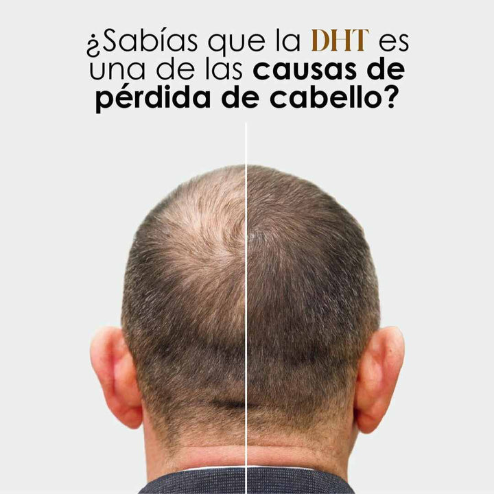 DHT Blocker Anticaída Premium – Cabello Fuerte y Abundante 🧔🏻‍♂️