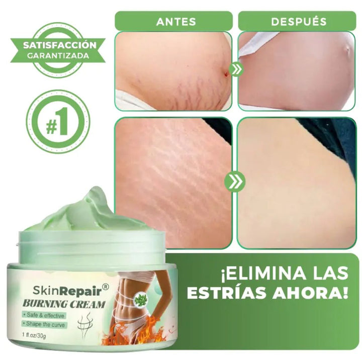 CREMA ANTIESTRÍAS SKINREPAIR 🌼💧