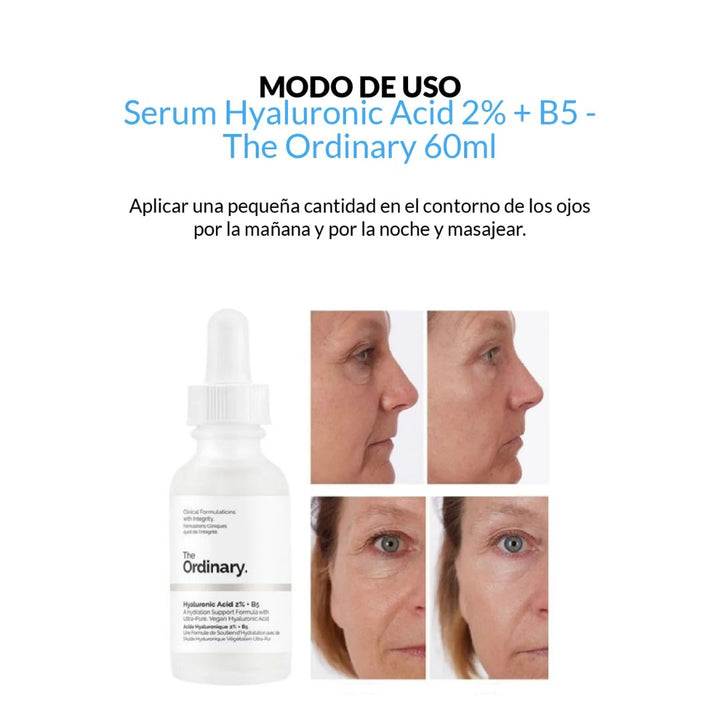 ÁCIDO HIALURÓNICO 2% + B5 THE ORDINARY✨👵🏻
