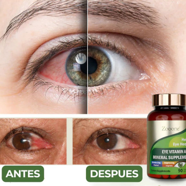 Zooone™- Suplemento de protección y salud ocular👁️💫