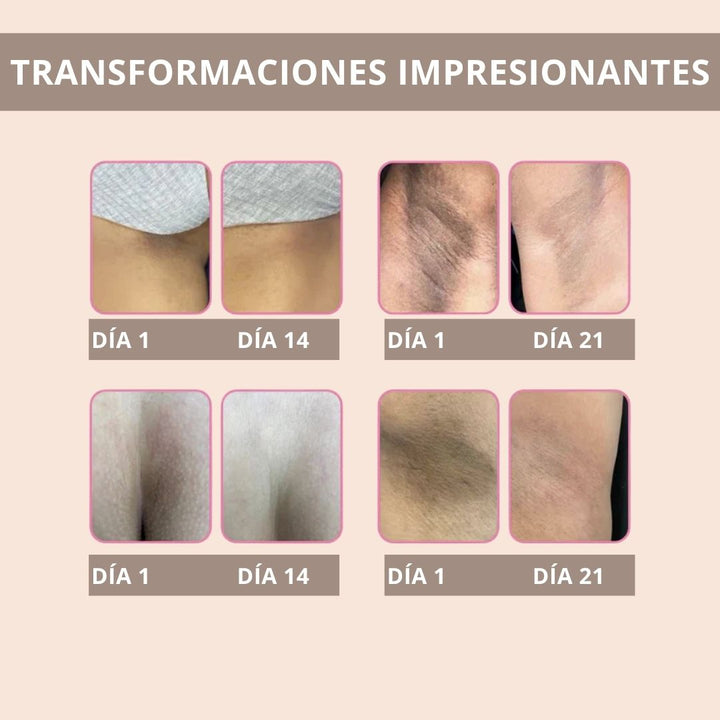 SKYNGLOW™ Crema Aclarante 60 ml ✨